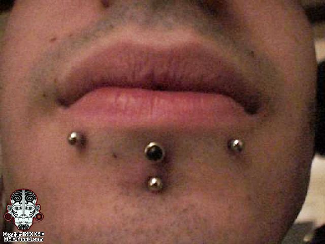  A pic of my four labret piercings. The upper 3 were done my Jason 